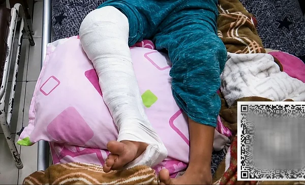 Urgente ayuda para Lexi: una niña que necesita una cirugía