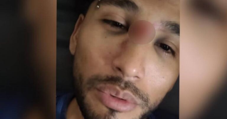 El cantante Jeiky Maya relata el accidente que sufrió en La Paz